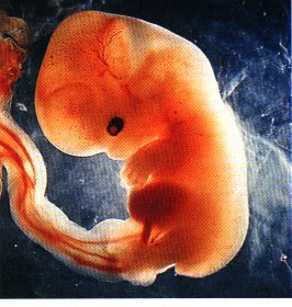 foetus-1-mois-MPI1