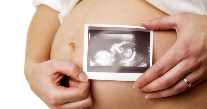 pregnant-ultrasound-baby-fetus
